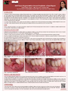 Soft Tissue Augmentation Around Implants a Case Report